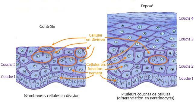 EMF effects on keratinocytes: dermis observation