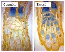 EMF effects on bones: experiments